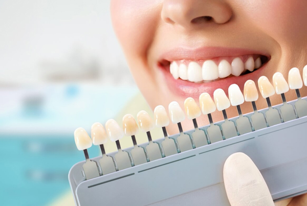 Teeth Whitening