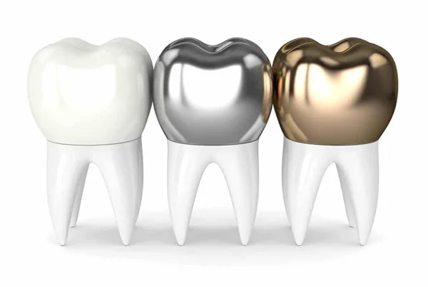 Metal Crown