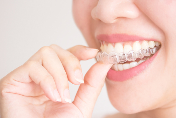 Aligners