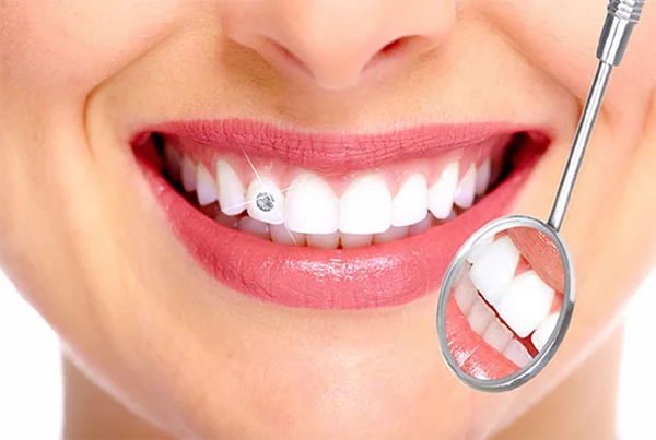 Dental Jewellery