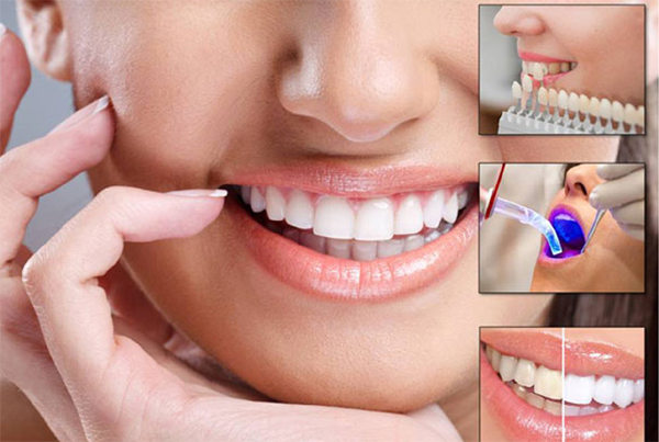 Cosmetic Dental Treatments